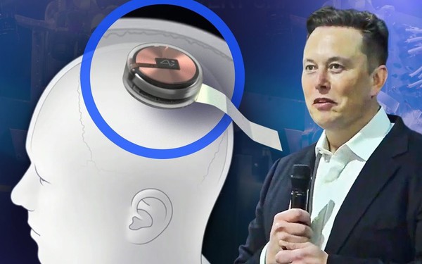 Elon Musk: 'Công ty của tôi tự tin cấy chip vào não người trong 6 tháng tới'