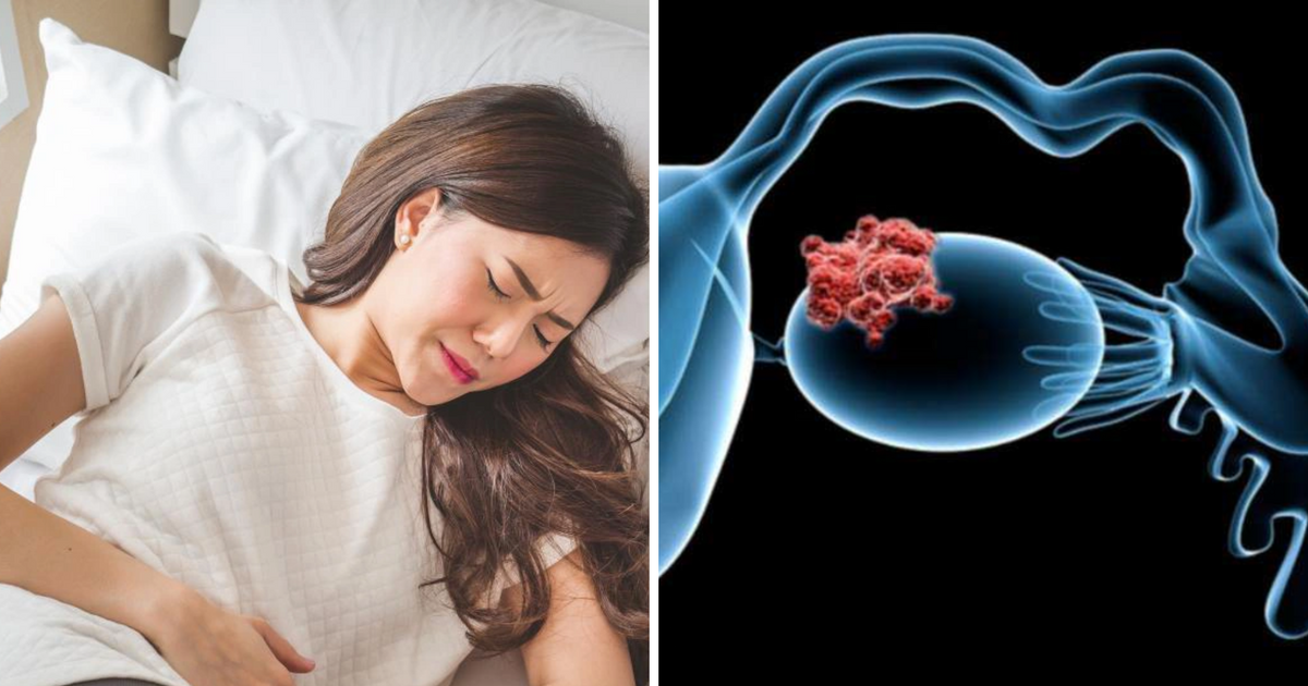 4 dấu hiệu có thể là cảnh báo sớm của ung thư buồng trứng: Bác sĩ nói 'phải đi khám ngay khi phát hiện'